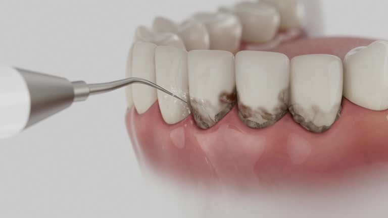 Reliable Teeth Cleaning And Checkup contractor in Jefferson County County, GA by Dentist Open Now